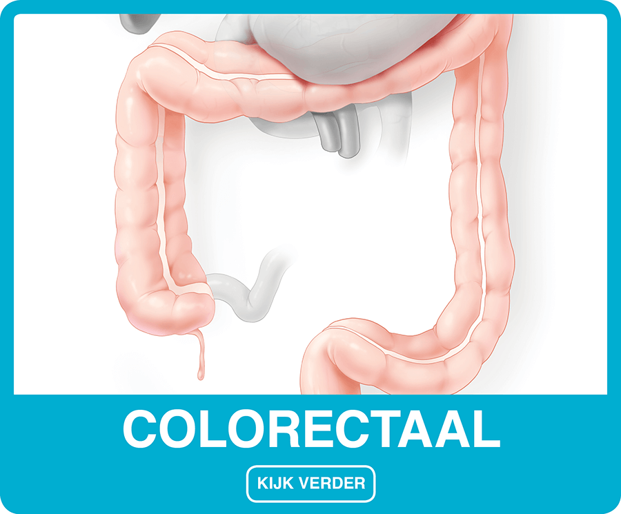 Colorectaal