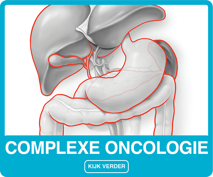 Complexe oncologie